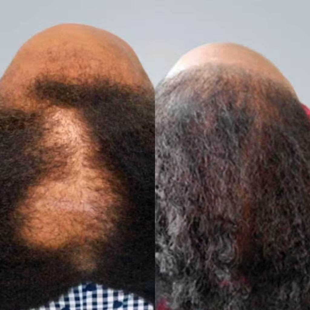 EdgeGrow —Peptide Scalp Serum for Black Hair