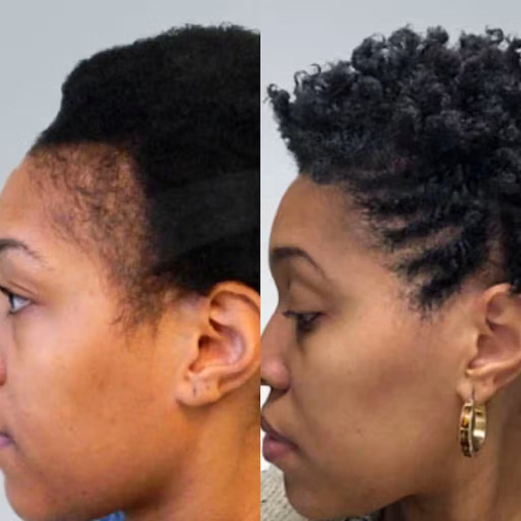 EdgeGrow —Peptide Scalp Serum for Black Hair