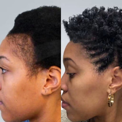 EdgeGrow —Peptide Scalp Serum for Black Hair