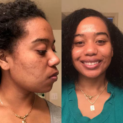 EdgeGrow —Peptide Scalp Serum for Black Hair