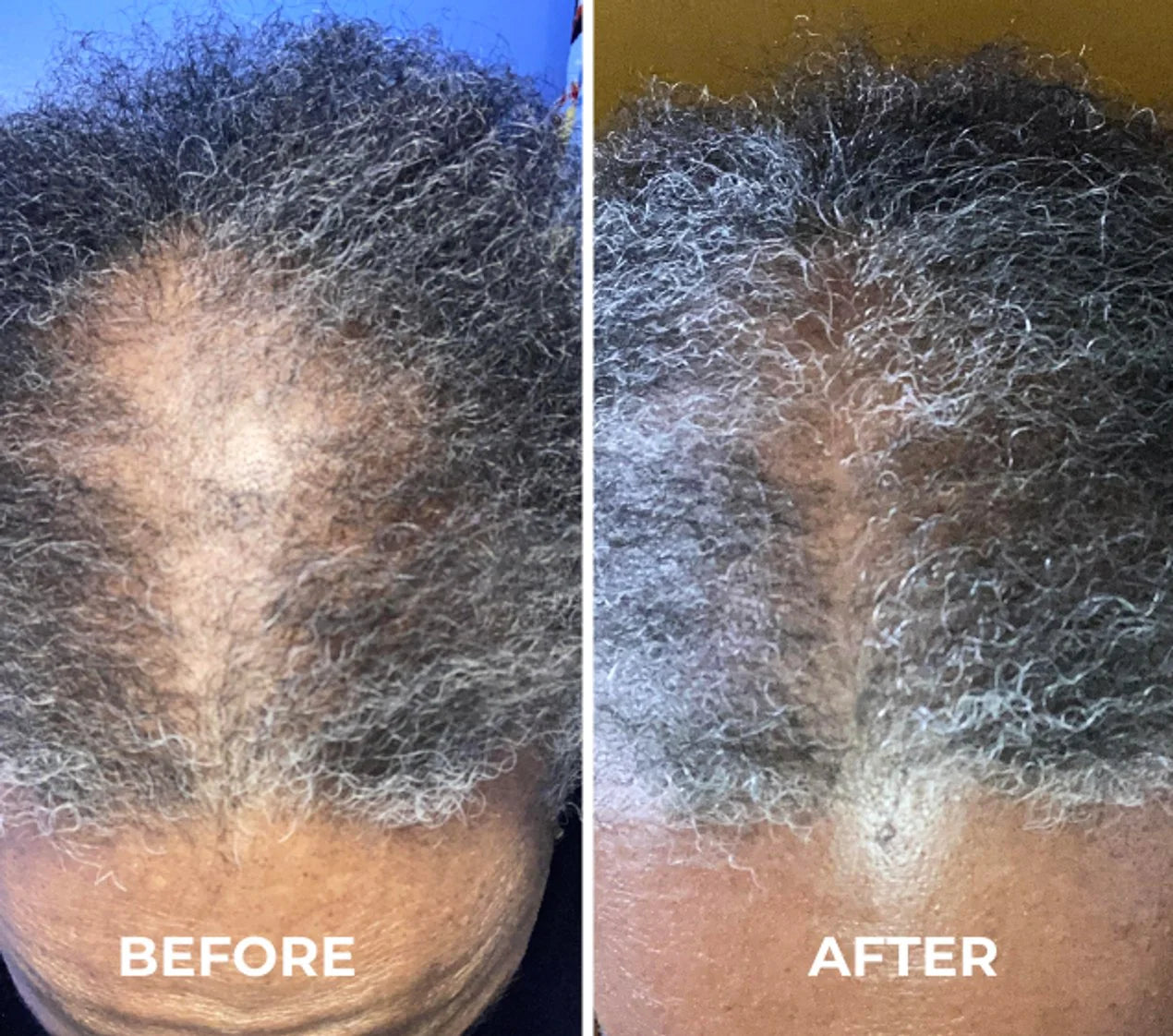 EdgeGrow —Peptide Scalp Serum for Black Hair