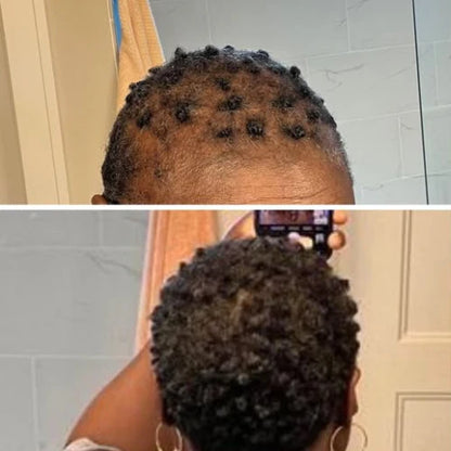 EdgeGrow —Peptide Scalp Serum for Black Hair