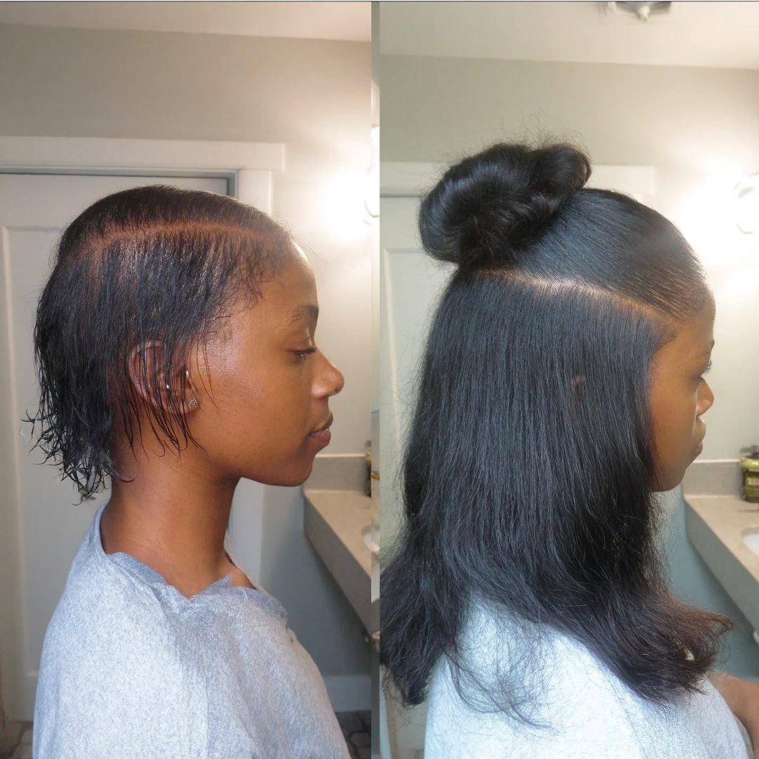 EdgeGrow —Peptide Scalp Serum for Black Hair